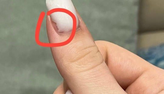 Сколы и отслойки по бокам и с торца? Пытаемся разобрать причину по фото. Ищем способы устранения